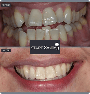 Smile gallery 1